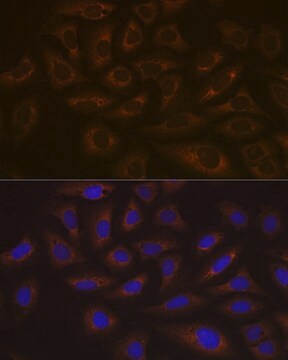 Anti-UBE2C Antibody, clone 5G5L9, Rabbit Monoclonal