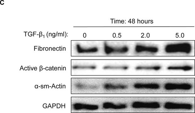 Anti-Active-&#946;-Catenin (Anti-ABC) Antibody, clone 8E7 clone 8E7, Upstate&#174;, from mouse