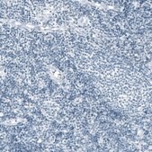 Monoclonal Anti-PRL antibody produced in mouse Prestige Antibodies&#174; Powered by Atlas Antibodies, clone CL6559, purified immunoglobulin, buffered aqueous glycerol solution
