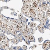 Anti-PDE3A antibody produced in rabbit Prestige Antibodies&#174; Powered by Atlas Antibodies, affinity isolated antibody, buffered aqueous glycerol solution