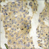 Anti-phospho-CaMK2 (pThr286) antibody produced in rabbit affinity isolated antibody