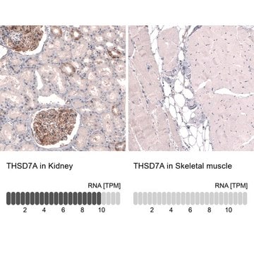 Monoclonal Anti-THSD7A antibody produced in mouse Prestige Antibodies&#174; Powered by Atlas Antibodies, clone CL3779, purified immunoglobulin, buffered aqueous glycerol solution