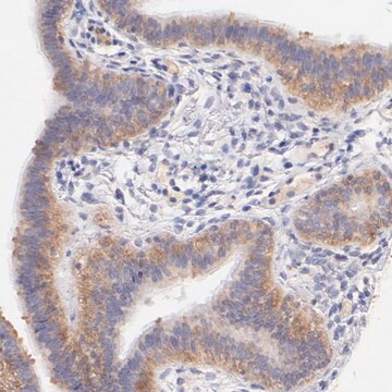 Anti-RPL11 antibody produced in rabbit Prestige Antibodies&#174; Powered by Atlas Antibodies, affinity isolated antibody, buffered aqueous glycerol solution