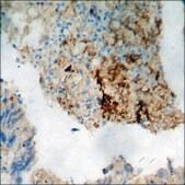 Anti-phospho-PI3-kinase p85-&#945;/&#947; (pTyr467/199) antibody produced in rabbit affinity isolated antibody