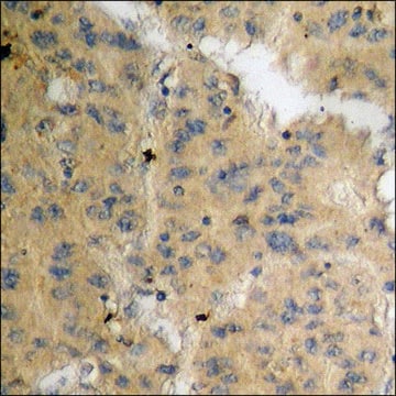 Anti-phospho-LIMK1 (pThr508) antibody produced in rabbit affinity isolated antibody