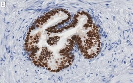 Anti-HNF-3A/FOXA1 Antibody, clone 1E5 ZooMAb&#174; Rabbit Monoclonal recombinant, expressed in HEK 293 cells