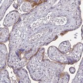 Monoclonal Anti-HER2 antibody produced in mouse Prestige Antibodies&#174; Powered by Atlas Antibodies, clone CL0268, purified immunoglobulin, buffered aqueous glycerol solution