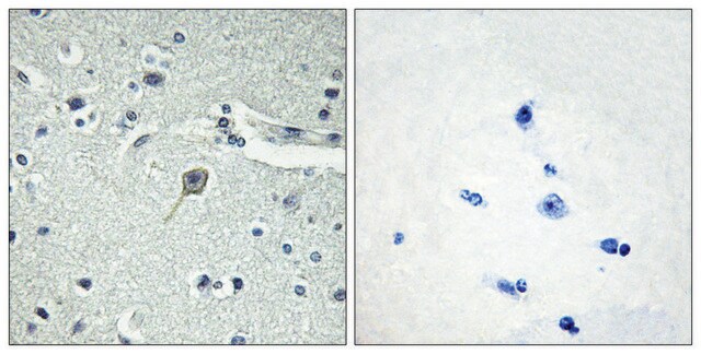 Anti-PTHR1 antibody produced in rabbit affinity isolated antibody