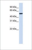 Anti-TUBA4A antibody produced in rabbit affinity isolated antibody