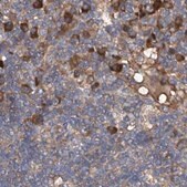 Anti-ASCC3 antibody produced in rabbit Prestige Antibodies&#174; Powered by Atlas Antibodies, affinity isolated antibody, buffered aqueous glycerol solution, ab1