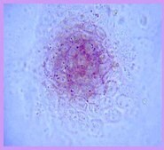 ES Cell Characterization Kit The Embryonic Stem Cell Characterization Kit phenotypically assesses the differentiation status of ES cells by measuring their AP activity, cell-surface stage-specific antigens (SSEA-1, SSEA-4) as well as expression of TRA-1-60, TRA-1-81 antigens.