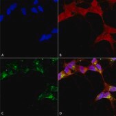 Monoclonal Anti-GABRB3 antibody produced in mouse clone S87-25, 1&#160;mg/mL, purified immunoglobulin