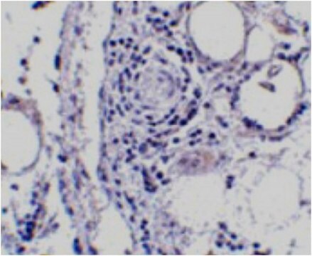 Anti-FABP7 Antibody from rabbit, purified by affinity chromatography