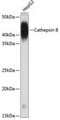 Anti-Cathepsin B Antibody, clone 6I5D7, Rabbit Monoclonal