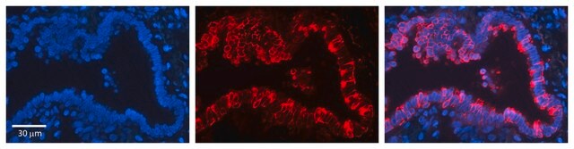 Anti-KRT7 antibody produced in rabbit affinity isolated antibody