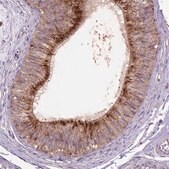Anti-GLB1 antibody produced in rabbit Prestige Antibodies&#174; Powered by Atlas Antibodies, affinity isolated antibody, buffered aqueous glycerol solution