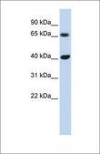 Anti-CCND1 (ab3) antibody produced in rabbit affinity isolated antibody