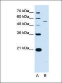 Anti-KCNQ2 (AB2) antibody produced in rabbit affinity isolated antibody