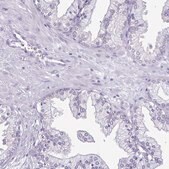 Anti-TNNI3 antibody produced in rabbit Prestige Antibodies&#174; Powered by Atlas Antibodies, affinity isolated antibody, buffered aqueous glycerol solution
