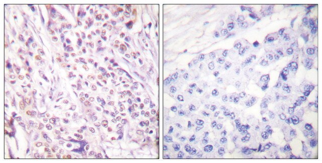 Anti-RAD17 antibody produced in rabbit affinity isolated antibody