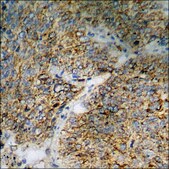 Anti-phospho-BAD (pSer112) antibody produced in rabbit affinity isolated antibody