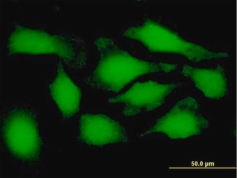 Anti-PSMD9 antibody produced in mouse purified immunoglobulin, buffered aqueous solution