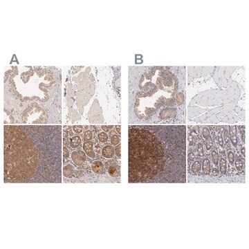 Anti-PRKCD antibody produced in rabbit Ab1, Prestige Antibodies&#174; Powered by Atlas Antibodies, affinity isolated antibody, buffered aqueous glycerol solution