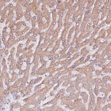 Anti-HSD17B7 antibody produced in rabbit Prestige Antibodies&#174; Powered by Atlas Antibodies, affinity isolated antibody, buffered aqueous glycerol solution