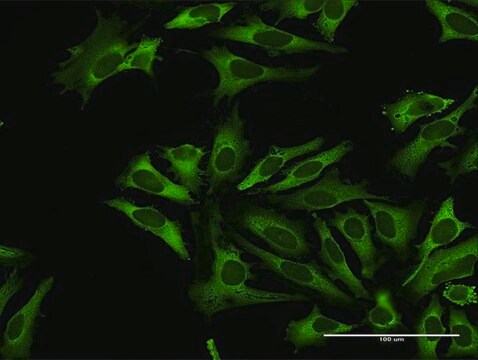 Anti-RARS antibody produced in rabbit purified immunoglobulin, buffered aqueous solution