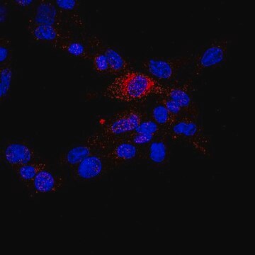 Anti-TIMP-3 Antibody, CT from rabbit, purified by affinity chromatography