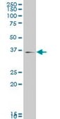 Monoclonal Anti-MAPK14, (C-terminal) antibody produced in mouse clone 3D5, ascites fluid