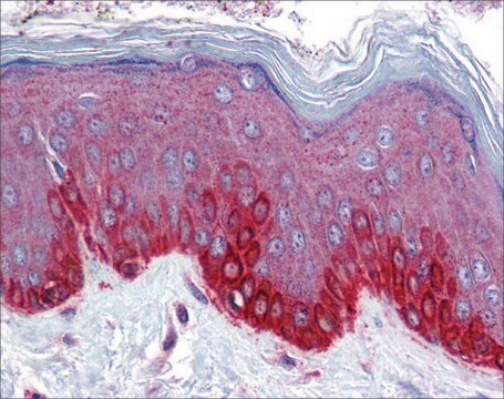 Anti-FZD4 antibody produced in rabbit affinity isolated antibody