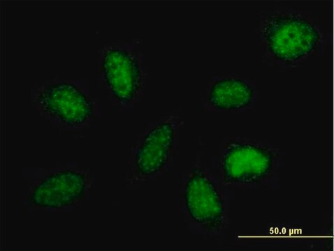 Anti-IXL antibody produced in mouse purified immunoglobulin, buffered aqueous solution