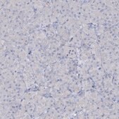 Anti-ATP4A antibody produced in rabbit Prestige Antibodies&#174; Powered by Atlas Antibodies, affinity isolated antibody, buffered aqueous glycerol solution