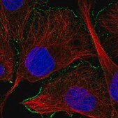 Anti-CAMK2A antibody produced in rabbit Prestige Antibodies&#174; Powered by Atlas Antibodies, affinity isolated antibody, buffered aqueous glycerol solution