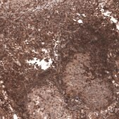 Anti-TRIM21 antibody produced in rabbit Prestige Antibodies&#174; Powered by Atlas Antibodies, affinity isolated antibody, buffered aqueous glycerol solution