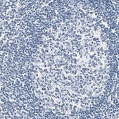 Anti-CA1 antibody produced in rabbit Prestige Antibodies&#174; Powered by Atlas Antibodies, affinity isolated antibody, buffered aqueous glycerol solution