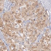 Anti-ARG1 antibody produced in rabbit Prestige Antibodies&#174; Powered by Atlas Antibodies, affinity isolated antibody, buffered aqueous glycerol solution