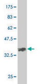 Monoclonal Anti-EPHA2 antibody produced in mouse clone 1E3, purified immunoglobulin, buffered aqueous solution