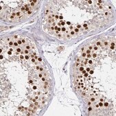 Anti-ANLN antibody produced in rabbit Prestige Antibodies&#174; Powered by Atlas Antibodies, affinity isolated antibody, buffered aqueous glycerol solution