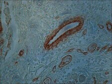Monoclonal Anti-Collagen, Type IV antibody produced in mouse clone COL-94, ascites fluid