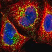 Anti-TOP1MT antibody produced in rabbit Prestige Antibodies&#174; Powered by Atlas Antibodies, affinity isolated antibody, buffered aqueous glycerol solution