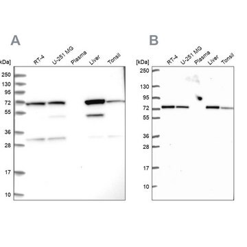 Anti-SDHA antibody produced in rabbit Prestige Antibodies&#174; Powered by Atlas Antibodies, affinity isolated antibody, buffered aqueous glycerol solution