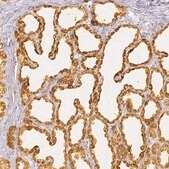 Anti-CSN1S1 antibody produced in rabbit Prestige Antibodies&#174; Powered by Atlas Antibodies, affinity isolated antibody, buffered aqueous glycerol solution