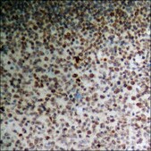 Anti-phospho-PTPRA (pTyr798) antibody produced in rabbit affinity isolated antibody