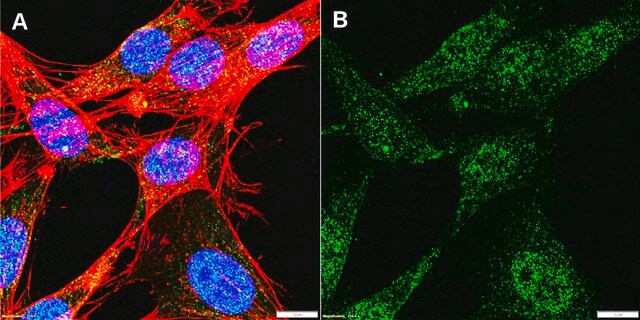 Anti-FKHR/FOXO1 Antibody, clone 1D21 ZooMAb&#174; Rabbit Monoclonal recombinant, expressed in HEK 293 cells