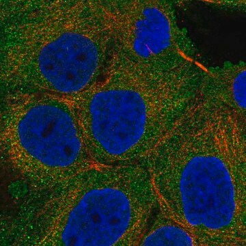 Anti-Tnk2 Antibody Produced In Rabbit Prestige Antibodies&#174; Powered by Atlas Antibodies, affinity isolated antibody, buffered aqueous glycerol solution