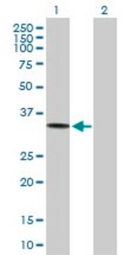 Anti-ACP5 antibody produced in mouse purified immunoglobulin, buffered aqueous solution