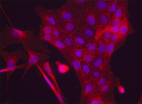 Anti-VASP (C-terminal) antibody produced in rabbit ~1.5&#160;mg/mL, affinity isolated antibody, buffered aqueous solution