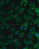 Anti-LGALS3 antibody produced in rabbit